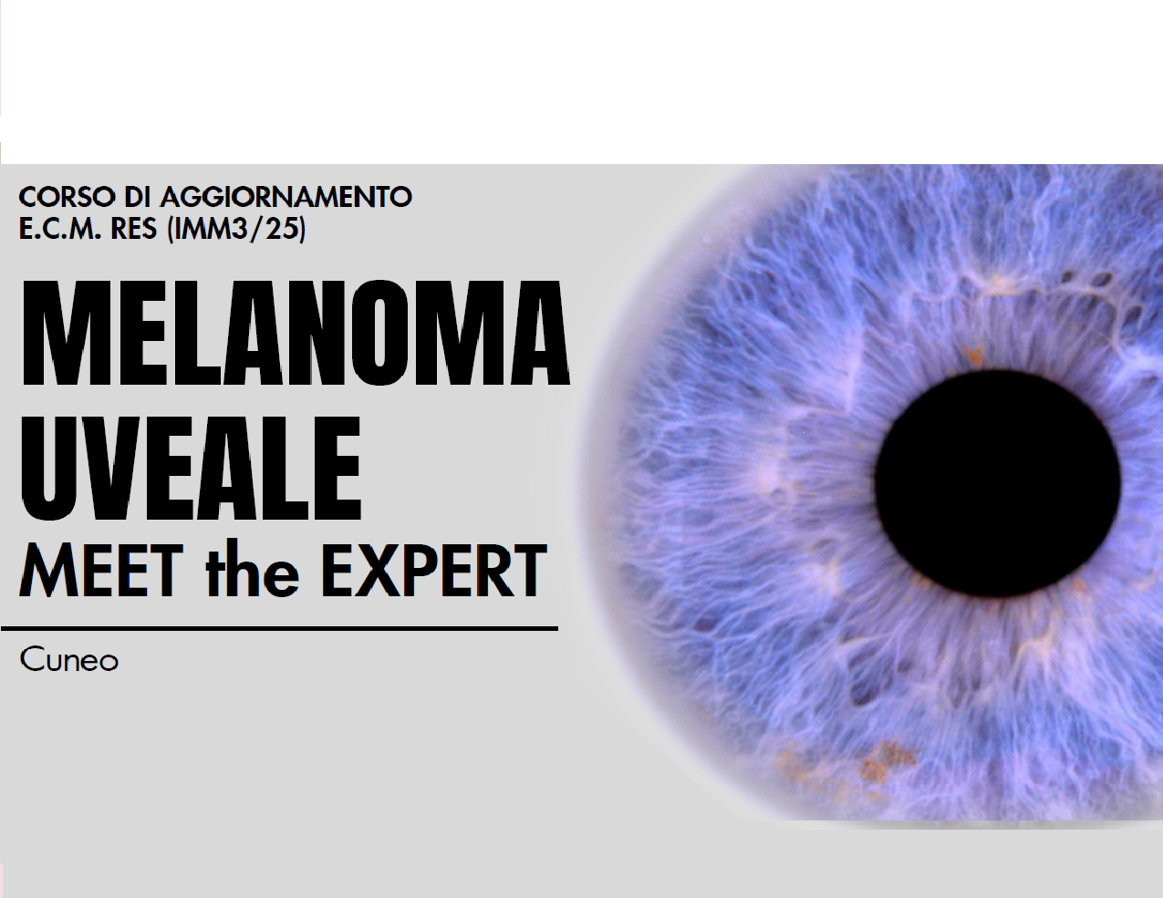 MEET THE EXPERT: MELANOMA UVEALE (IMM3/25)