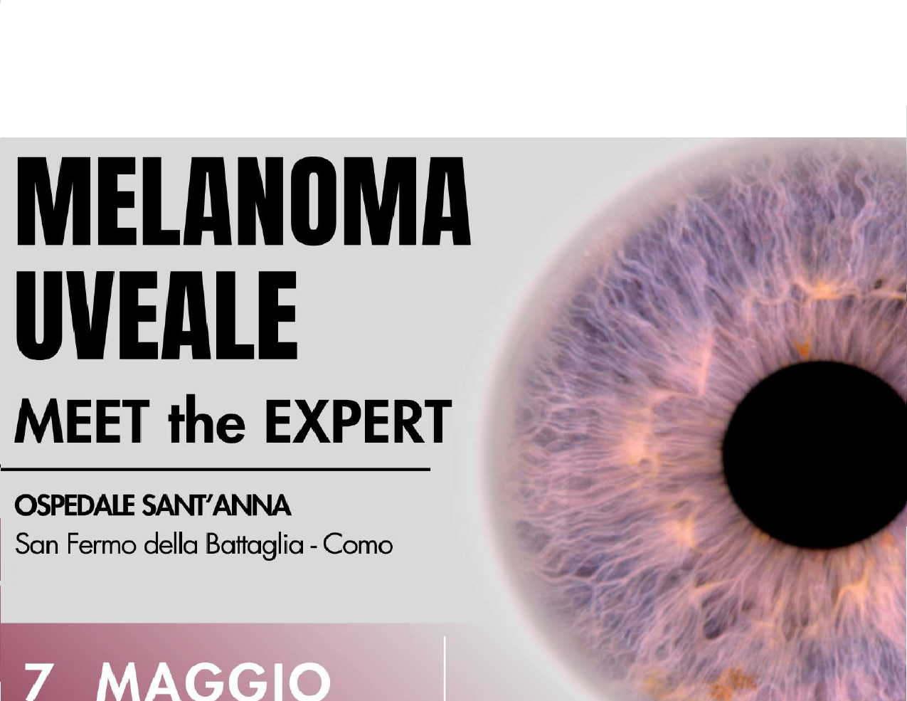 MEET THE EXPERT: MELANOMA UVEALE (IMM4/25)