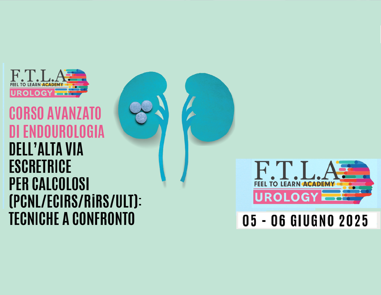 CORSO AVANZATO DI ENDOUROLOGIA DELL’ALTA VIA ESCRETRICE PER CALCOLOSI (PCNL/ECIRS/RiRS/ULT): TECNICHE A CONFRONTO (IRCCSURmov/25)